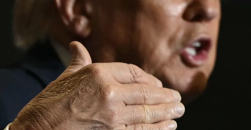 ترامب يكسّر صمته بشأن سبب ظهور كدمات على يده