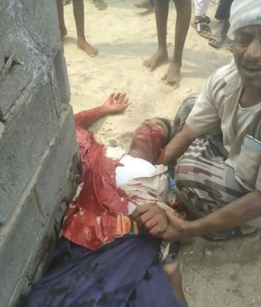 Houthi Gunman Kills Unarmed Displaced Man While Receiving Aid in Hodeidah